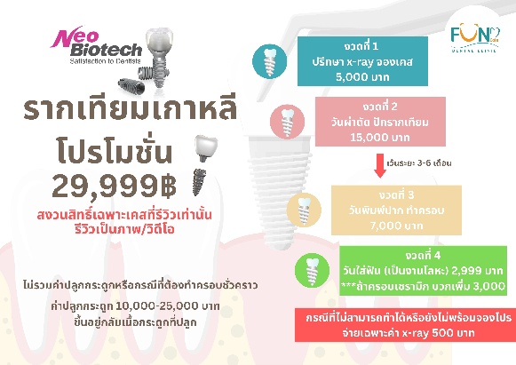 โปรรากเทียมเกาหลี Neo Biotech 29,999 บาท