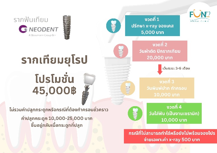 โปรรากเทียมยุโรป Neodent 45,000 บาท