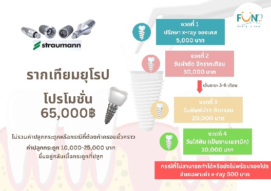 โปรรากเทียมยุโรป Straumann 65,000 บาท