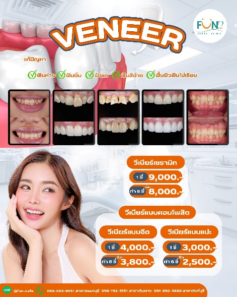 โปรโมชันวีนียร์ Fun Cafe Dental ราคาเริ่มต้น 2,500 บาท