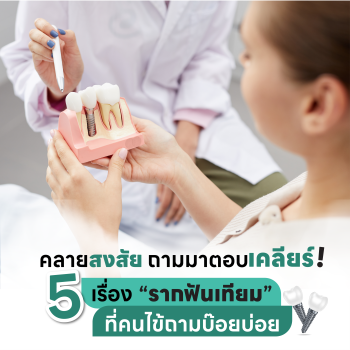 บทความ 5 เรื่องรากฟันเทียมที่คนไข้ถามบ่อย
