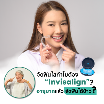 บทความจัดฟันใสทำไมต้อง Invisalign อายุเยอะแล้วจัดฟันได้ไหม