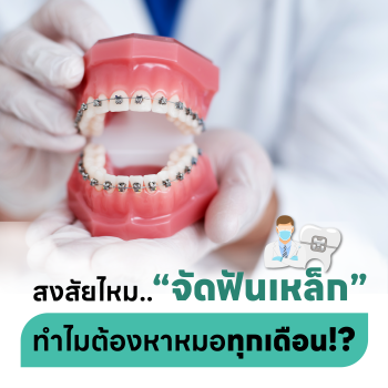 บทความจัดฟันเหล็กทำไมต้องหาหมอทุกเดือน