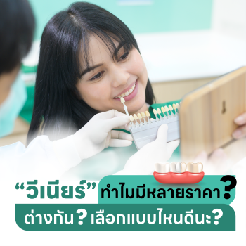 บทความวีเนียร์ทำไมมีหลายราคา ต่างกันอย่างไร เลือกแบบไหนดี